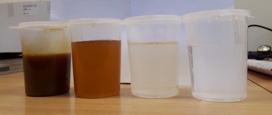 Refining process for chicory root fibre at the Oreye production plant
